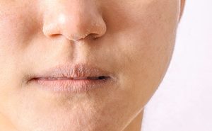 सर्दियों में बढ़ती Winter Skin Sensitivity