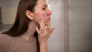 सर्दियों में बढ़ती Winter Skin Sensitivity