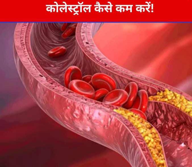 Cholesterol Control Ayurveda: