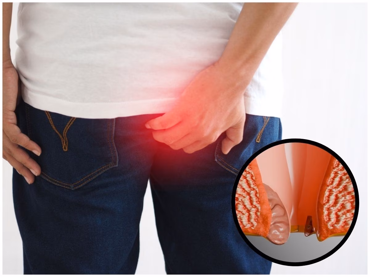 कहीं आप तो नहीं दे रहे पाइल्स की समस्या को दावत?