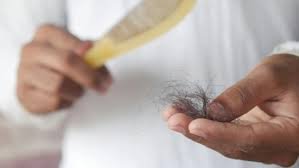 Hair Fall Reasons: कैसे जानें बाल झड़ना नॉर्मल है या समस्या?