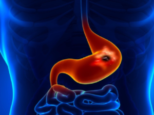 पेट दर्द के छिपे संकेत