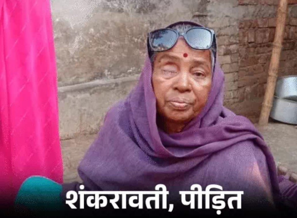 Gorakhpur News: आई कैम्प में मोतियाबिंद सर्जरी बनी मुसीबत: संक्रमण के बाद निकालनी पड़ी कई मरीजों की आंखें