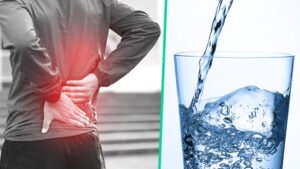 किडनी स्टोन रोकथाम के लिए पानी जरूरी