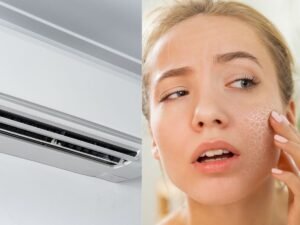 गर्मियों में स्किन कैसे बचाएं