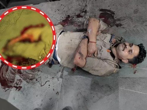 चोर का पीछा कर रहे सिपाही के दोनों पैर कटे