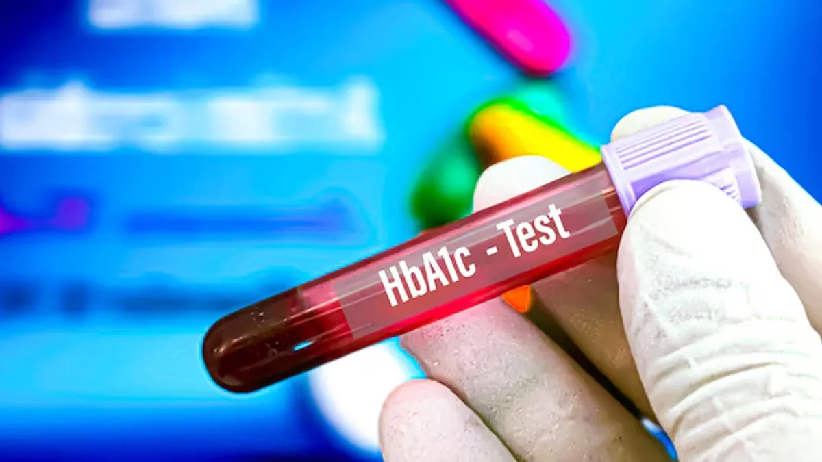 HbA1c Control Tips: