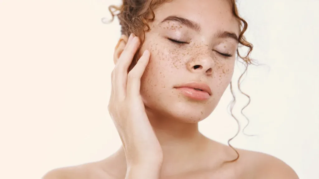 Melasma Dark Spots:
