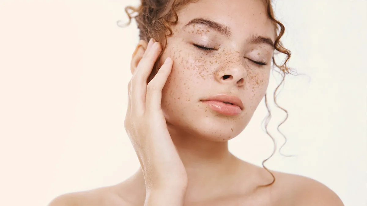 Melasma Dark Spots: