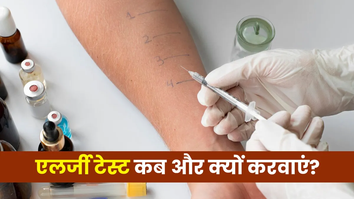 Allergy Test: