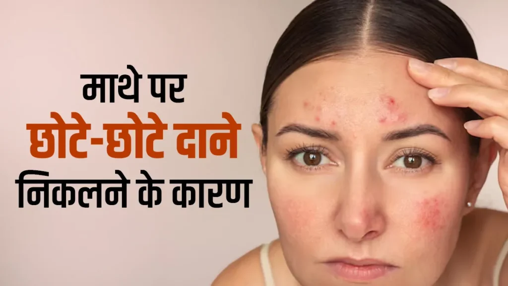 Forehead Small Bumps: