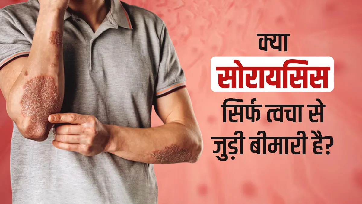 Psoriasis Disease: