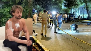 Tiger Shroff: हमले के बाद टाइगर श्रॉफ की तस्वीर